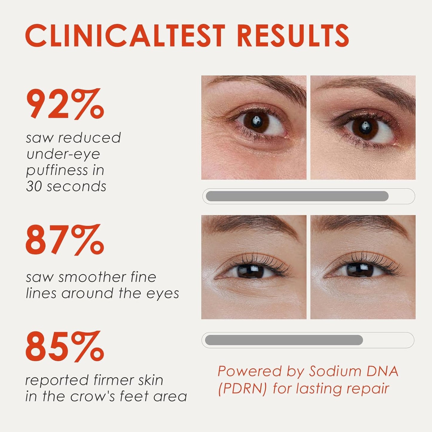 Hoygi™ Under Eye Bag Eraser